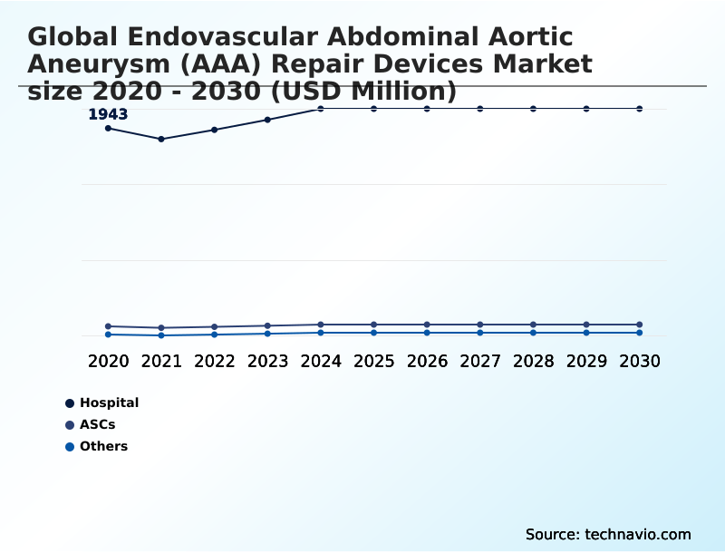 Foundry Equipment Market Size