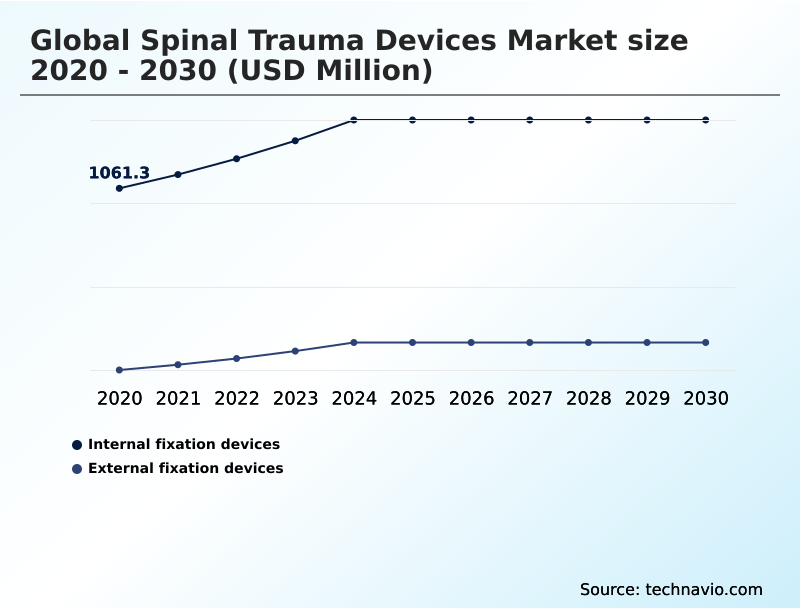 Foundry Equipment Market Size