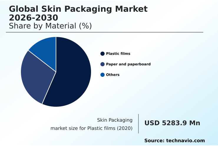 Foundry Equipment Market Size