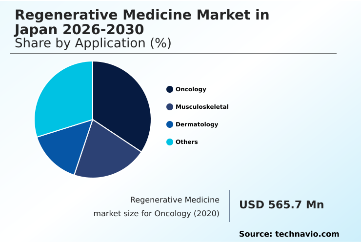 Foundry Equipment Market Size