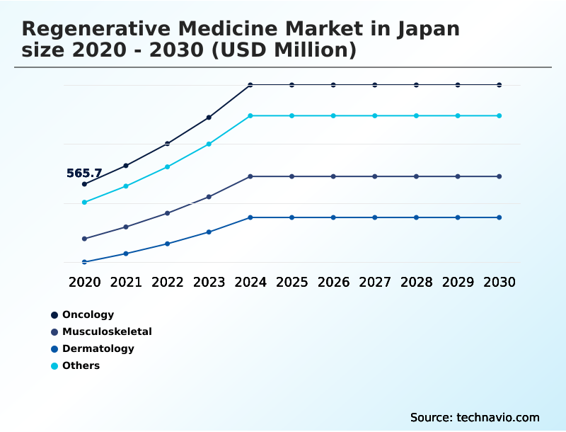 Foundry Equipment Market Size