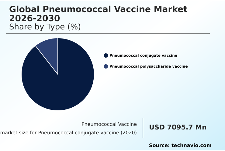 Foundry Equipment Market Size