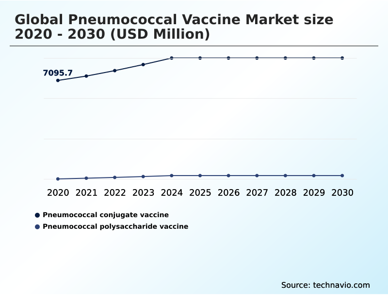 Foundry Equipment Market Size