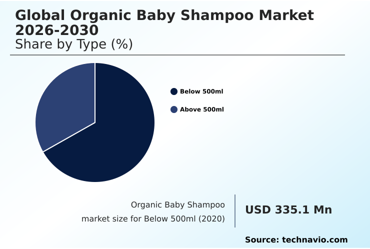 Foundry Equipment Market Size