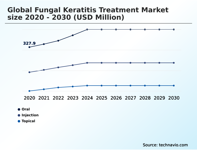 Foundry Equipment Market Size