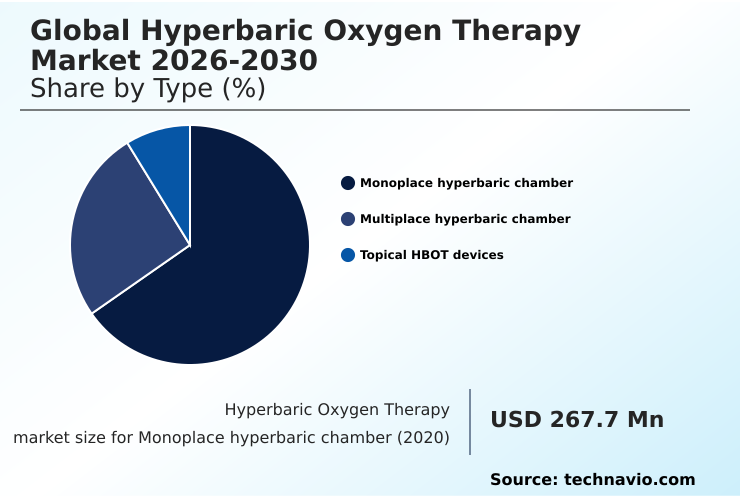 Foundry Equipment Market Size
