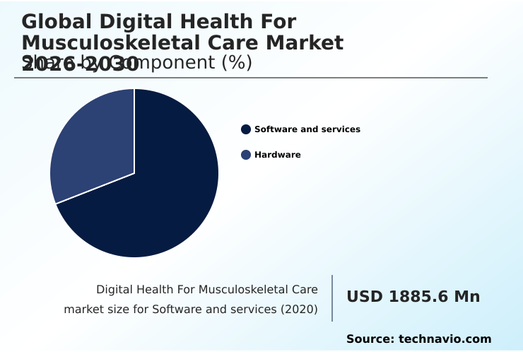 Foundry Equipment Market Size