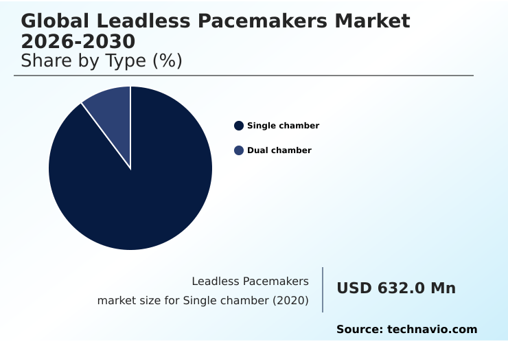 Foundry Equipment Market Size
