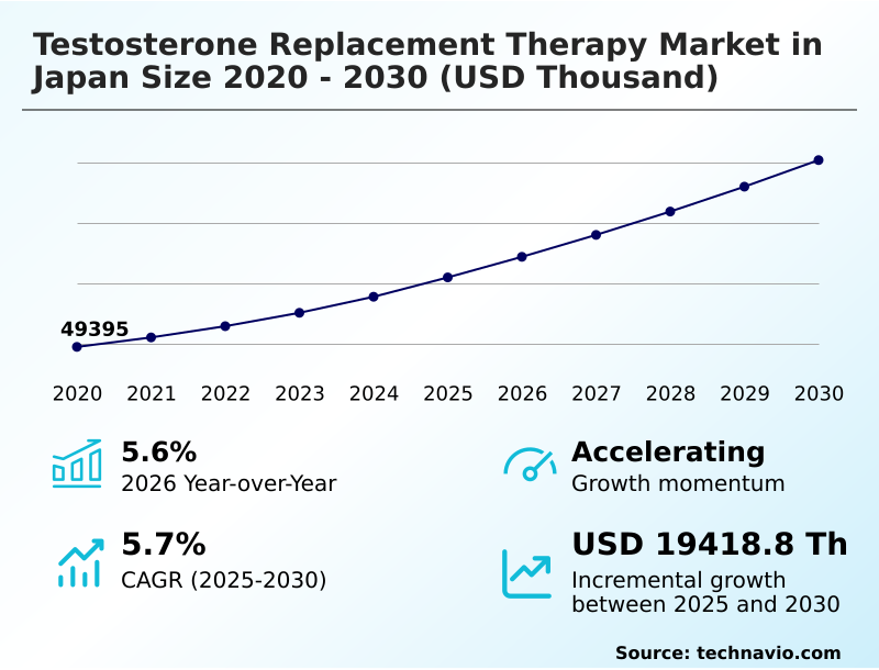 Foundry Equipment Market Size