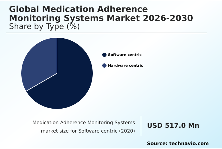 Foundry Equipment Market Size