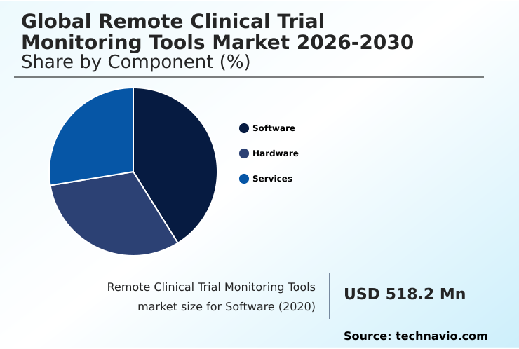 Foundry Equipment Market Size